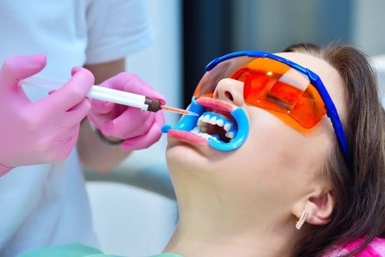 Get a brighter smile in minutes with instant results whitening West Bromwich