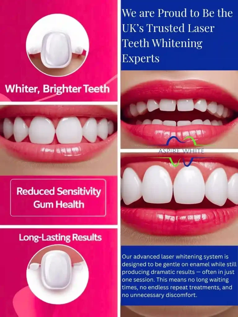 We are Proud to Be the UK’s Trusted Laser Teeth Whitening Experts West Bromwich