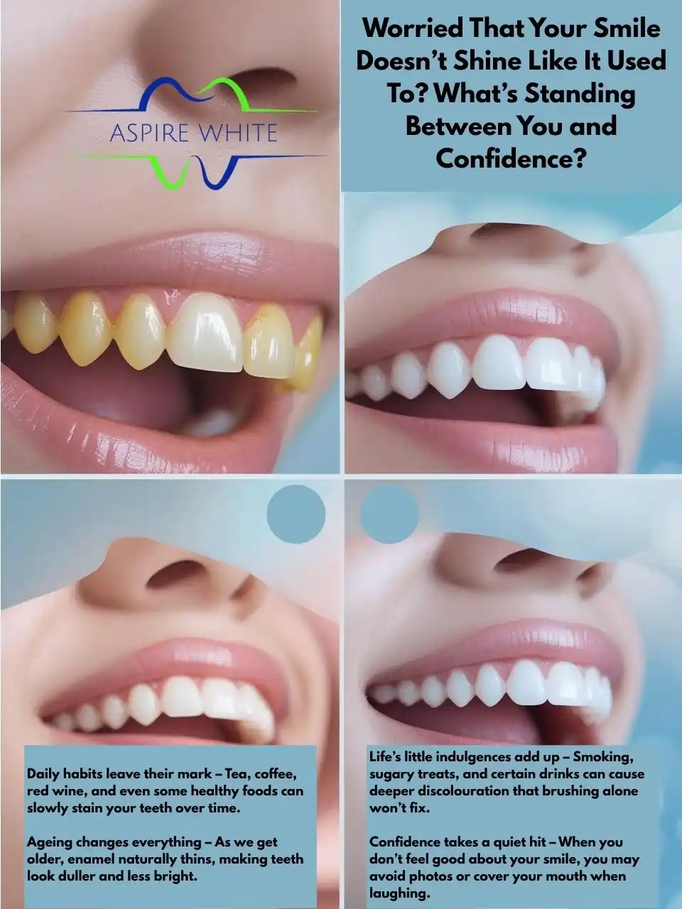Worried That Your Smile Doesn’t Shine Like It Used To What’s Standing Between You and Confidence West Bromwich